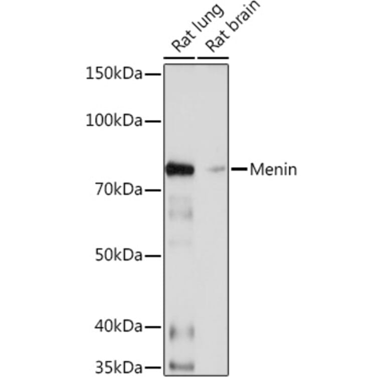 Western Blot - Anti-Menin Antibody [ARC1968] (A309122) - Antibodies.com