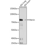 Western Blot - Anti-Menin Antibody [ARC1968] (A309122) - Antibodies.com