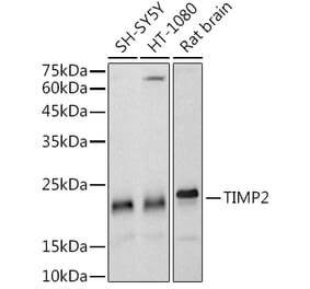 Western Blot - Anti-TIMP2 Antibody [ARC51187] (A309123) - Antibodies.com