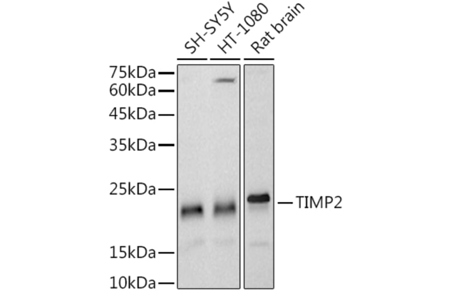 Western Blot - Anti-TIMP2 Antibody [ARC51187] (A309123) - Antibodies.com