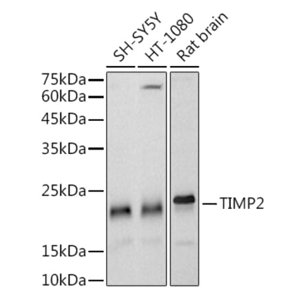 Western Blot - Anti-TIMP2 Antibody [ARC51187] (A309123) - Antibodies.com