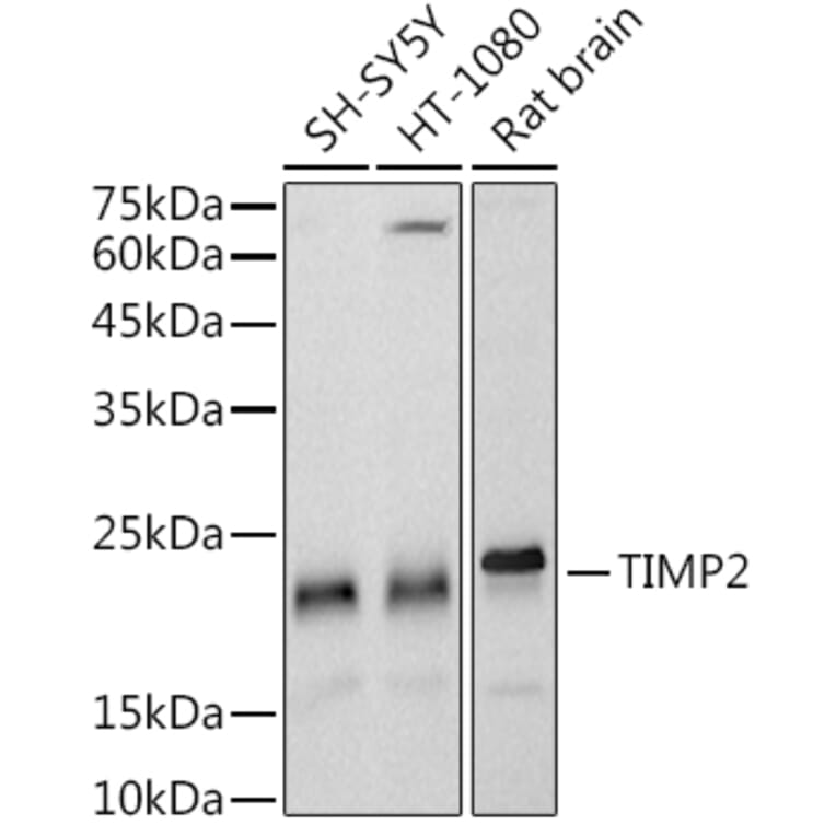 Western Blot - Anti-TIMP2 Antibody [ARC51187] (A309123) - Antibodies.com