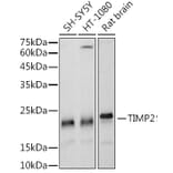 Western Blot - Anti-TIMP2 Antibody [ARC51187] (A309123) - Antibodies.com