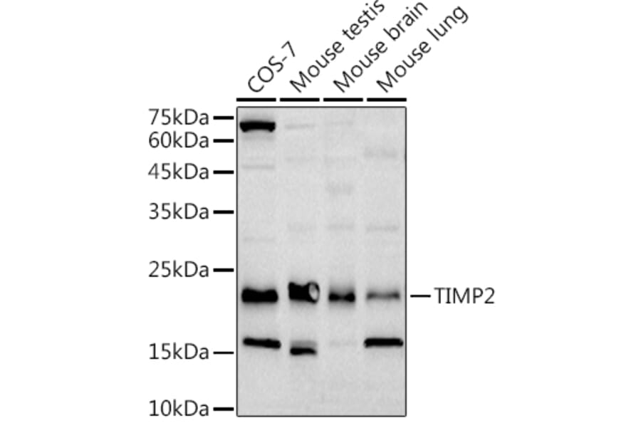 Western Blot - Anti-TIMP2 Antibody [ARC51187] (A309123) - Antibodies.com
