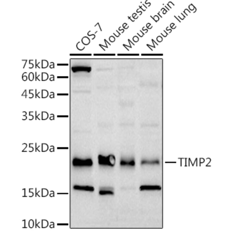 Western Blot - Anti-TIMP2 Antibody [ARC51187] (A309123) - Antibodies.com