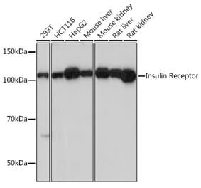 Western Blot - Anti-Insulin Receptor alpha Antibody [ARC0458] (A309125) - Antibodies.com