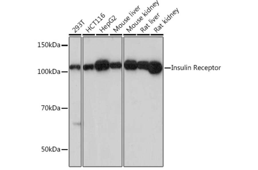 Western Blot - Anti-Insulin Receptor alpha Antibody [ARC0458] (A309125) - Antibodies.com