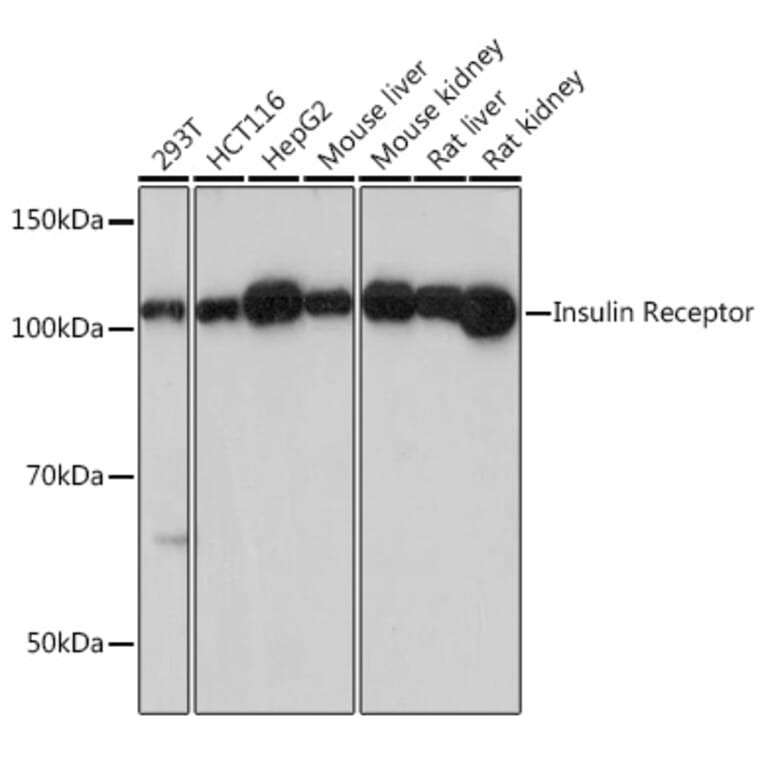 Western Blot - Anti-Insulin Receptor alpha Antibody [ARC0458] (A309125) - Antibodies.com