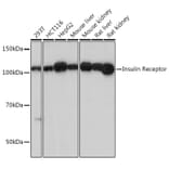 Western Blot - Anti-Insulin Receptor alpha Antibody [ARC0458] (A309125) - Antibodies.com