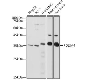 Western Blot - Anti-RIL Antibody (A309127) - Antibodies.com