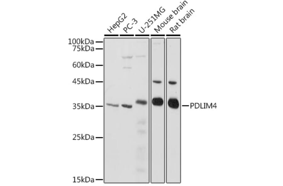Western Blot - Anti-RIL Antibody (A309127) - Antibodies.com