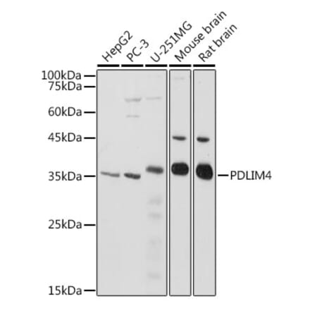 Western Blot - Anti-RIL Antibody (A309127) - Antibodies.com