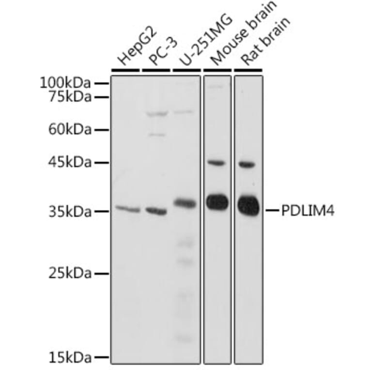 Western Blot - Anti-RIL Antibody (A309127) - Antibodies.com