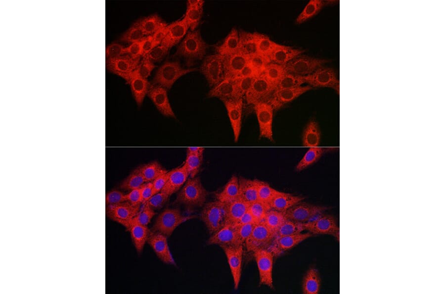 Immunofluorescence - Anti-RIL Antibody (A309127) - Antibodies.com