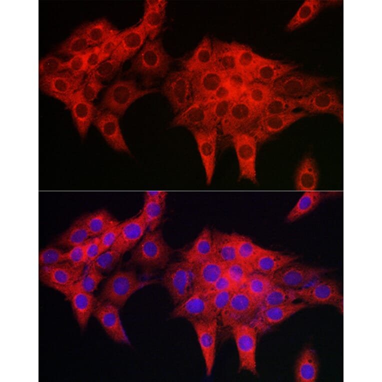 Immunofluorescence - Anti-RIL Antibody (A309127) - Antibodies.com