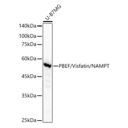 Western Blot - Anti-Visfatin Antibody [ARC53731] (A309128) - Antibodies.com