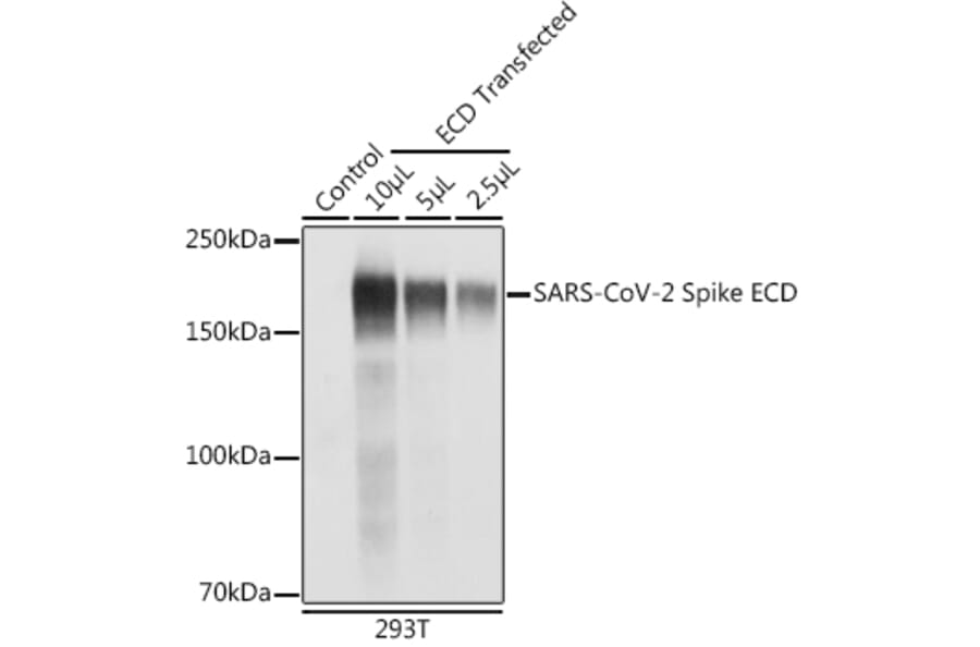 Western Blot - Anti-SARS-CoV-2 Spike Glycoprotein ECD Antibody (A309130) - Antibodies.com