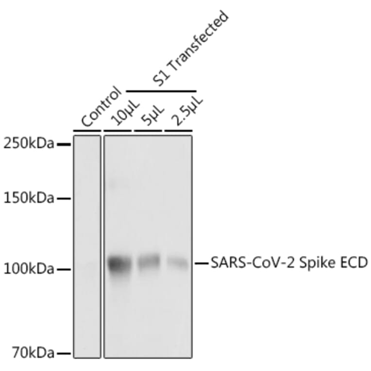 Western Blot - Anti-SARS-CoV-2 Spike Glycoprotein ECD Antibody (A309130) - Antibodies.com