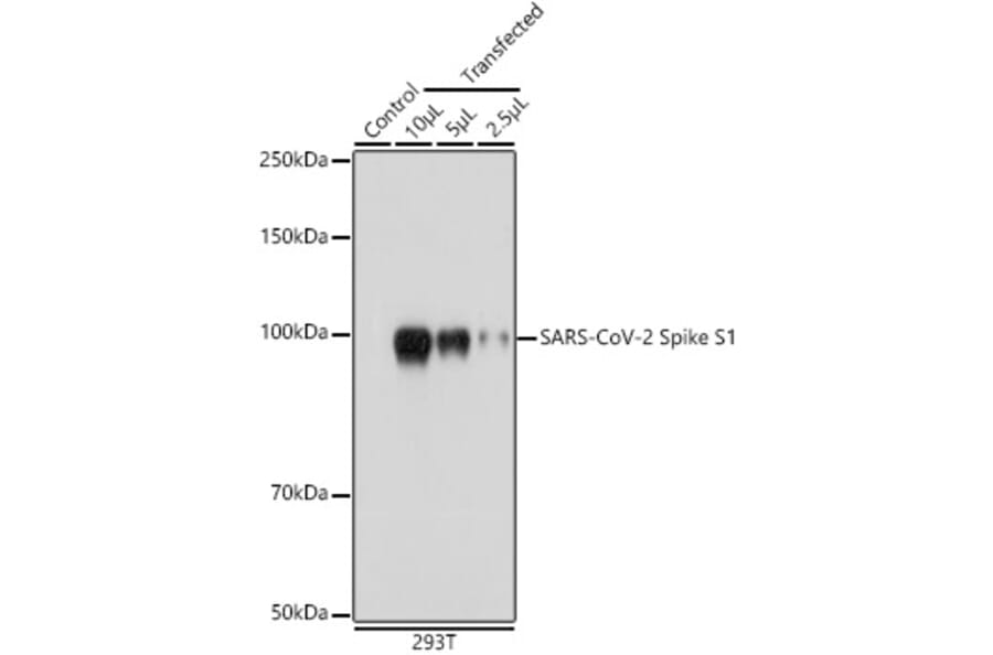 Western Blot - Anti-SARS-CoV-2 Spike Glycoprotein S1 Antibody (A309131) - Antibodies.com