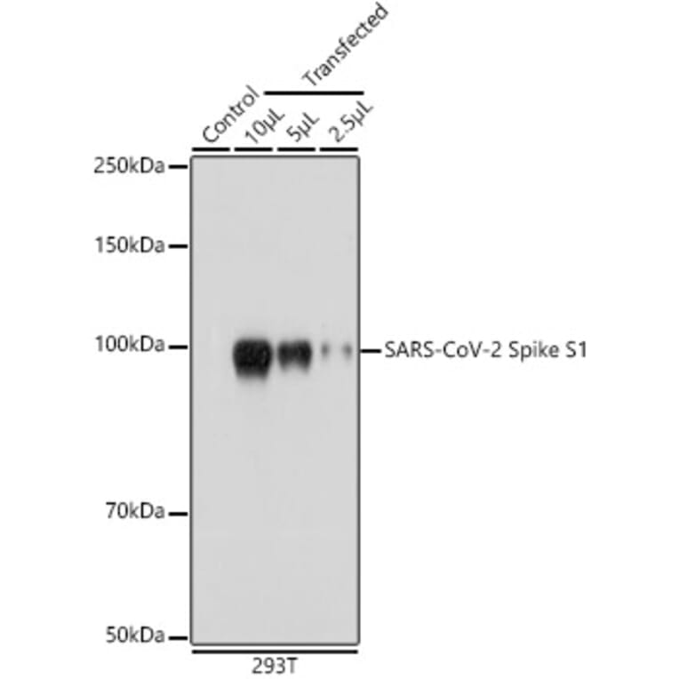 Western Blot - Anti-SARS-CoV-2 Spike Glycoprotein S1 Antibody (A309131) - Antibodies.com