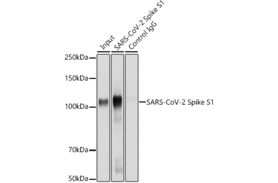 Western Blot - Anti-SARS-CoV-2 Spike Glycoprotein S1 Antibody (A309131) - Antibodies.com