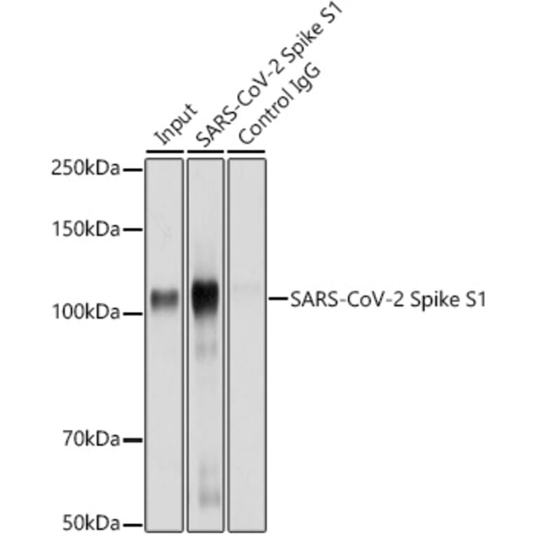 Western Blot - Anti-SARS-CoV-2 Spike Glycoprotein S1 Antibody (A309131) - Antibodies.com