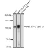 Western Blot - Anti-SARS-CoV-2 Spike Glycoprotein S1 Antibody (A309131) - Antibodies.com