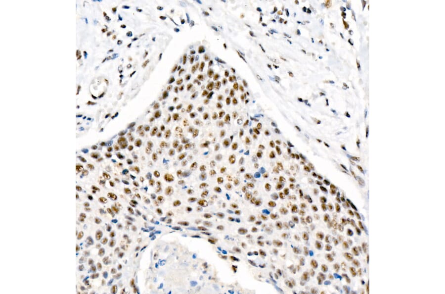 Immunohistochemistry - Anti-Chk2 (phospho Thr68) Antibody [ARC58395] (A309132) - Antibodies.com