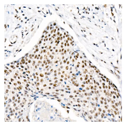 Immunohistochemistry - Anti-Chk2 (phospho Thr68) Antibody [ARC58395] (A309132) - Antibodies.com