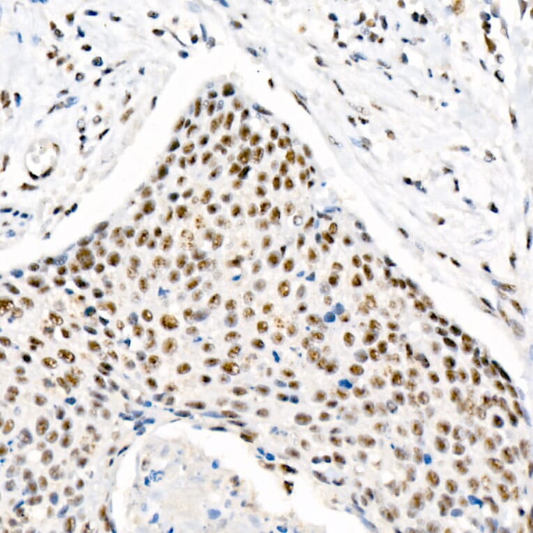 Immunohistochemistry - Anti-Chk2 (phospho Thr68) Antibody [ARC58395] (A309132) - Antibodies.com