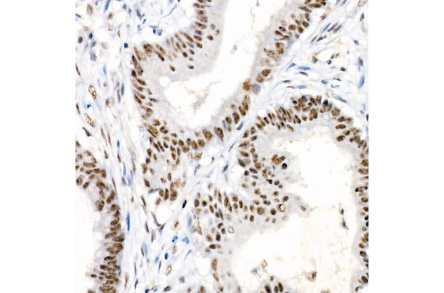 Immunohistochemistry - Anti-Chk2 (phospho Thr68) Antibody [ARC58395] (A309132) - Antibodies.com