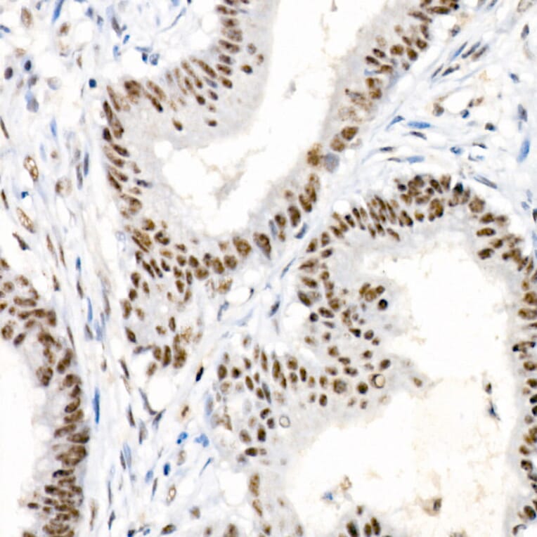 Immunohistochemistry - Anti-Chk2 (phospho Thr68) Antibody [ARC58395] (A309132) - Antibodies.com
