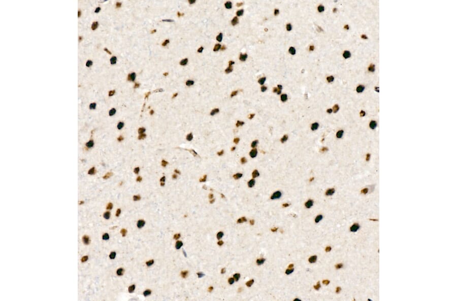 Immunohistochemistry - Anti-Chk2 (phospho Thr68) Antibody [ARC58395] (A309132) - Antibodies.com
