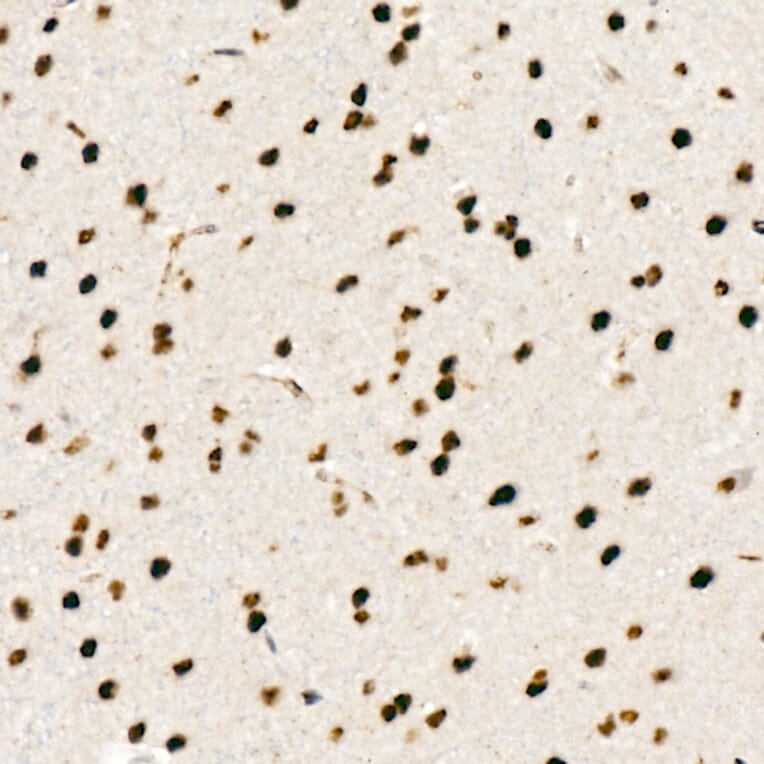 Immunohistochemistry - Anti-Chk2 (phospho Thr68) Antibody [ARC58395] (A309132) - Antibodies.com