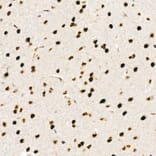Immunohistochemistry - Anti-Chk2 (phospho Thr68) Antibody [ARC58395] (A309132) - Antibodies.com
