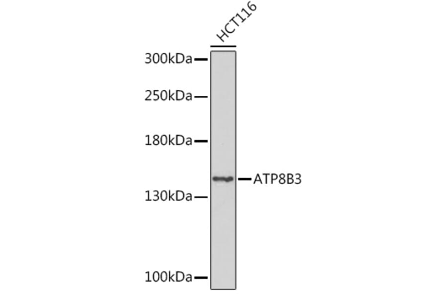 Western Blot - Anti-ATP8B3 Antibody (A309133) - Antibodies.com