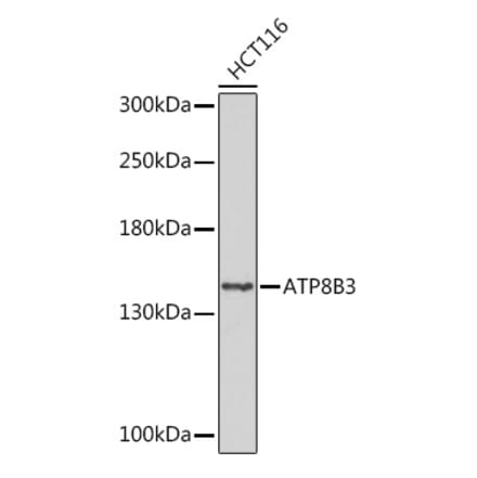 Western Blot - Anti-ATP8B3 Antibody (A309133) - Antibodies.com