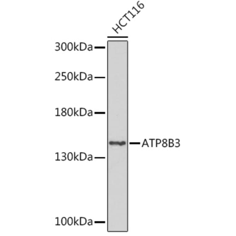 Western Blot - Anti-ATP8B3 Antibody (A309133) - Antibodies.com