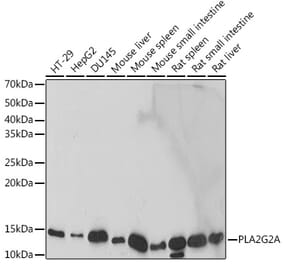Western Blot - Anti-Secretory phospholipase A2 Antibody [ARC2416] (A309136) - Antibodies.com
