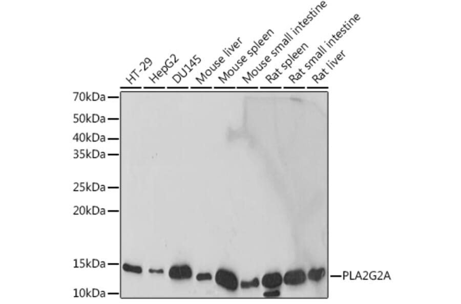 Western Blot - Anti-Secretory phospholipase A2 Antibody [ARC2416] (A309136) - Antibodies.com