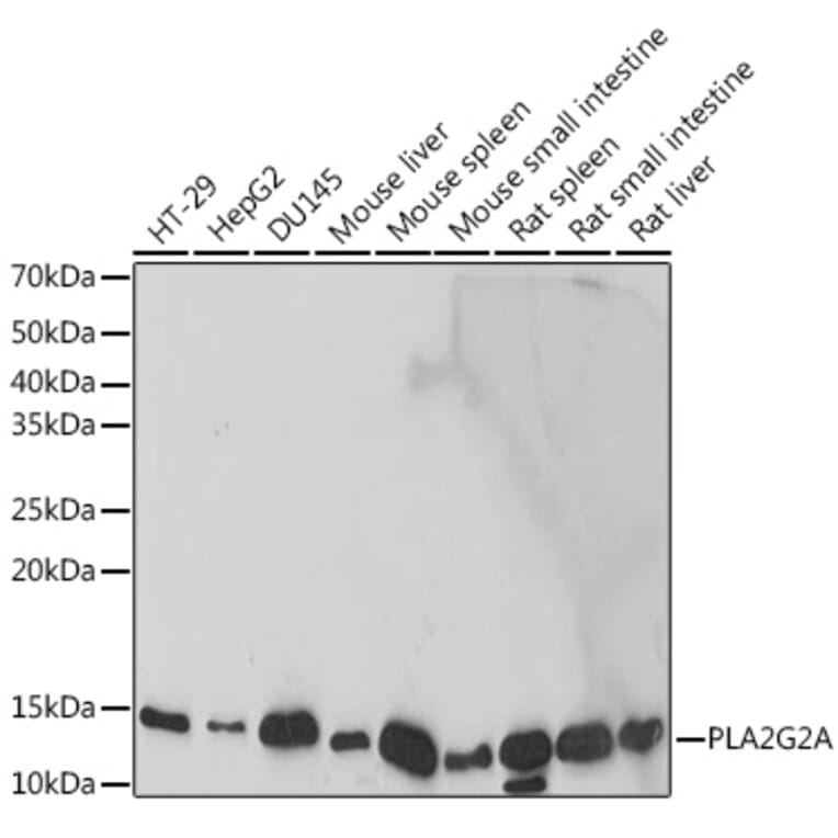 Western Blot - Anti-Secretory phospholipase A2 Antibody [ARC2416] (A309136) - Antibodies.com