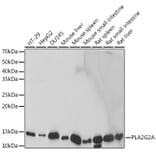 Western Blot - Anti-Secretory phospholipase A2 Antibody [ARC2416] (A309136) - Antibodies.com