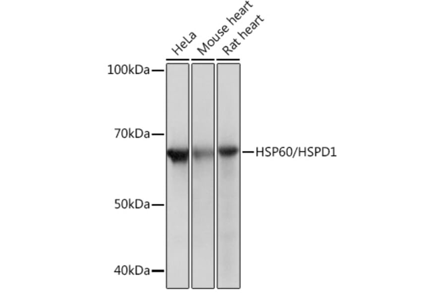Western Blot - Anti-HSP60 Antibody [ARC0260] (A309137) - Antibodies.com