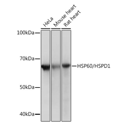 Western Blot - Anti-HSP60 Antibody [ARC0260] (A309137) - Antibodies.com