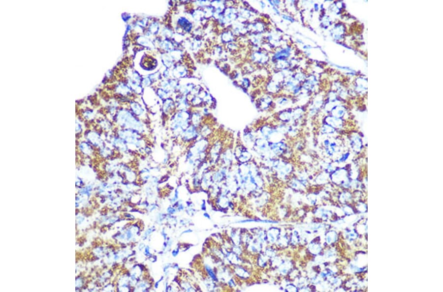 Immunohistochemistry - Anti-HSP60 Antibody [ARC0260] (A309137) - Antibodies.com