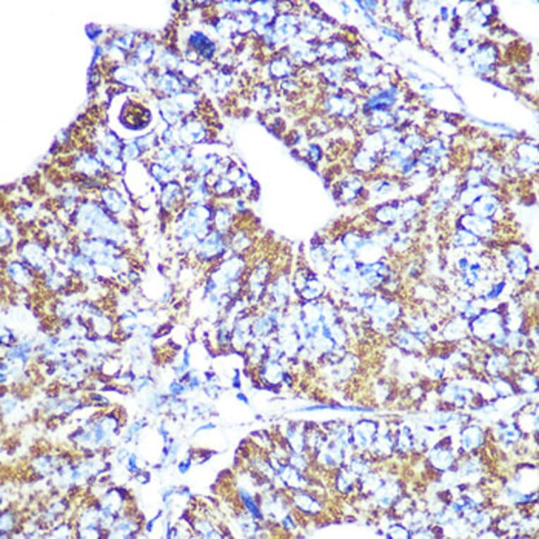 Immunohistochemistry - Anti-HSP60 Antibody [ARC0260] (A309137) - Antibodies.com