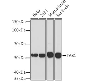 Western Blot - Anti-TAB1 Antibody [ARC1943] (A309138) - Antibodies.com