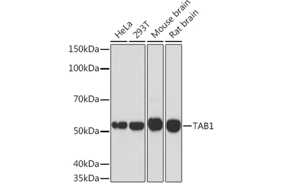 Western Blot - Anti-TAB1 Antibody [ARC1943] (A309138) - Antibodies.com
