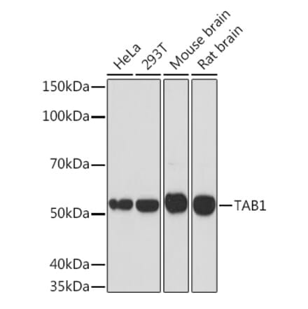 Western Blot - Anti-TAB1 Antibody [ARC1943] (A309138) - Antibodies.com