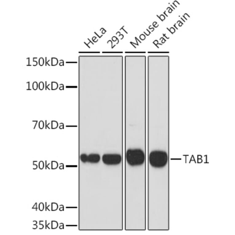 Western Blot - Anti-TAB1 Antibody [ARC1943] (A309138) - Antibodies.com